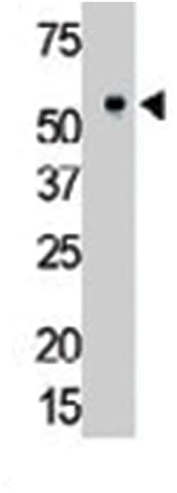 MATK, Rabbit, Polyclonal Antibody, Abnova 400 &mu;L | Buy Online | Abnova Corporation | Fisher Scientific