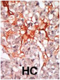 MATK, Rabbit, Polyclonal Antibody, Abnova 400 &mu;L | Buy Online | Abnova Corporation | Fisher Scientific