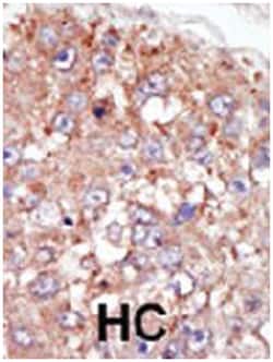 PTK6 Rabbit anti-Human, Polyclonal Antibody, Abnova 400 &mu;L | Buy Online | Abnova Corporation | Fisher Scientific