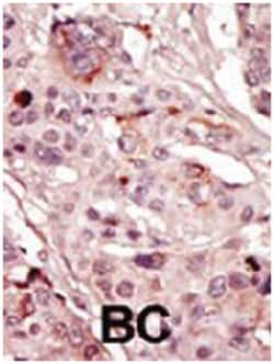 SRMS Rabbit anti-Human, Mouse, Polyclonal Antibody, Abnova 400 &mu;L | Buy Online | Abnova Corporation | Fisher Scientific