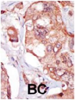 TNK1 Rabbit anti-Human, Polyclonal Antibody, Abnova 400 &mu;L | Buy Online | Abnova Corporation | Fisher Scientific