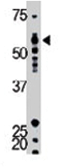 YES1, Rabbit, Polyclonal Antibody, Abnova 400 &mu;L | Buy Online | Abnova Corporation | Fisher Scientific