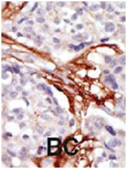 YES1, Rabbit, Polyclonal Antibody, Abnova 400 &mu;L | Buy Online | Abnova Corporation | Fisher Scientific