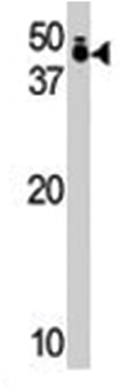 TRIB1, Rabbit, Polyclonal Antibody, Abnova 400&mu;L; Unlabeled:Antibodies,