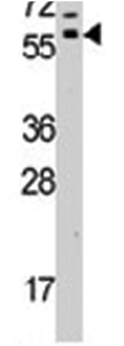 GRK7, Rabbit, Polyclonal Antibody, Abnova 400 &mu;L | Buy Online | Abnova Corporation | Fisher Scientific
