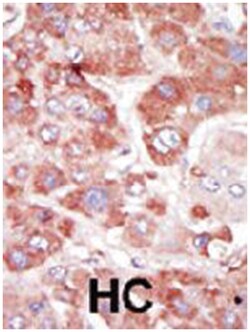 GRK7, Rabbit, Polyclonal Antibody, Abnova 400 &mu;L | Buy Online | Abnova Corporation | Fisher Scientific