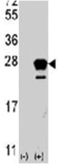 NRAS Rabbit anti-Human, Polyclonal Antibody, Abnova 400 &mu;L | Buy Online | Abnova Corporation | Fisher Scientific