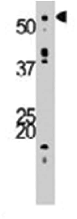 ACVR1B Rabbit anti-Human, Mouse, Polyclonal Antibody, Abnova 400 &mu;L | Buy Online | Abnova Corporation | Fisher Scientific