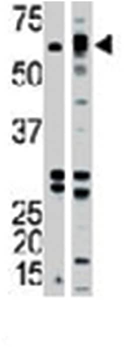 ACVR1B Rabbit anti-Human, Mouse, Polyclonal Antibody, Abnova 400&mu;L;
