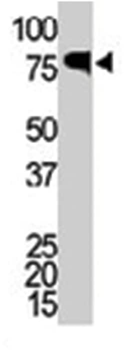 IRAK1 Rabbit anti-Human, Polyclonal Antibody, Abnova 400 &mu;L | Buy Online | Abnova Corporation | Fisher Scientific