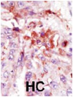 IRAK1 Rabbit anti-Human, Polyclonal Antibody, Abnova 400 &mu;L | Buy Online | Abnova Corporation | Fisher Scientific
