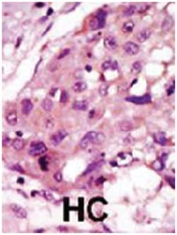 IRAK2 Rabbit anti-Human, Polyclonal Antibody, Abnova 400&mu;L; Unlabeled:Antibodies,
