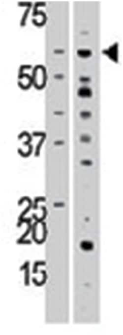 ACVR1 Rabbit anti-Human, Mouse, Polyclonal Antibody, Abnova 400 &mu;L | Buy Online | Abnova Corporation | Fisher Scientific