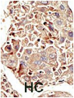 ACVR1 Rabbit anti-Human, Mouse, Polyclonal Antibody, Abnova 400 &mu;L | Buy Online | Abnova Corporation | Fisher Scientific