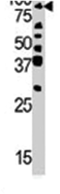 RIPK4, Rabbit, Polyclonal Antibody, Abnova 400 &mu;L | Buy Online | Abnova | Fisher Scientific