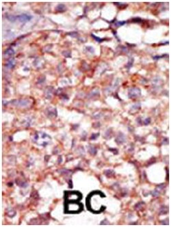 RIPK4, Rabbit, Polyclonal Antibody, Abnova 400 &mu;L | Buy Online | Abnova | Fisher Scientific