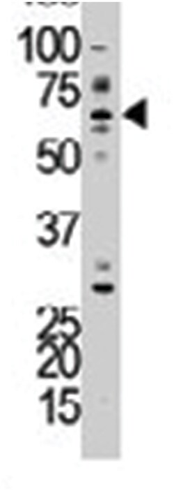 LIMK1 Rabbit anti-Human, Polyclonal Antibody, Abnova 400&mu;L; Unlabeled:Antibodies,