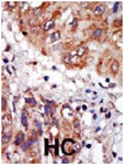 LIMK1 Rabbit anti-Human, Polyclonal Antibody, Abnova 400&mu;L; Unlabeled:Antibodies,