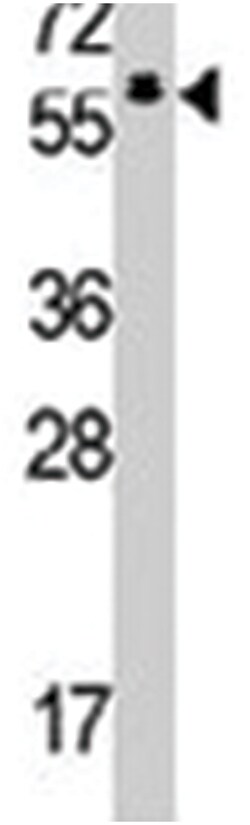 TESK2, Rabbit, Polyclonal Antibody, Abnova 400 &mu;L | Buy Online | Abnova Corporation | Fisher Scientific