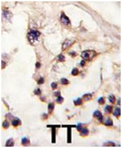 TESK2, Rabbit, Polyclonal Antibody, Abnova 400 &mu;L | Buy Online | Abnova Corporation | Fisher Scientific