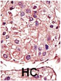 TGFBR1 Rabbit anti-Human, Mouse, Polyclonal Antibody, Abnova 400&mu;L;