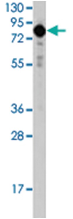 TGM2 Rabbit anti-Human, Polyclonal Antibody, Abnova 400 &mu;L | Buy Online | Abnova Corporation | Fisher Scientific