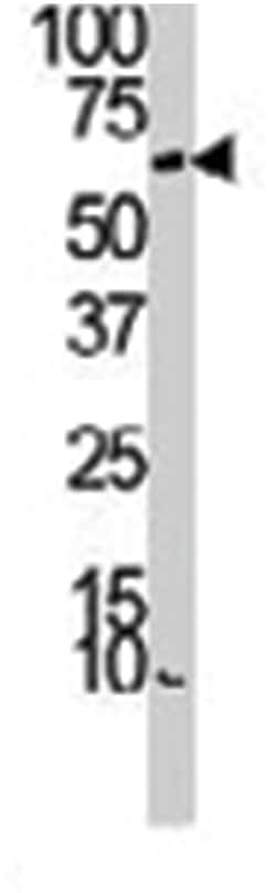 AURKA Rabbit anti-Human, Polyclonal Antibody, Abnova 400 &mu;L | Buy Online | Abnova Corporation | Fisher Scientific