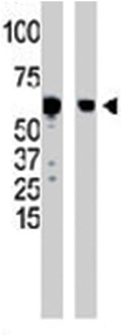 GCK Rabbit anti-Human, Mouse, Polyclonal Antibody, Abnova 400 &mu;L | Buy Online | Abnova Corporation | Fisher Scientific