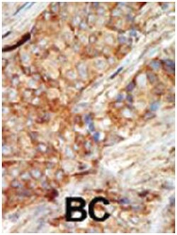 GCK Rabbit anti-Human, Mouse, Polyclonal Antibody, Abnova 400 &mu;L | Buy Online | Abnova Corporation | Fisher Scientific