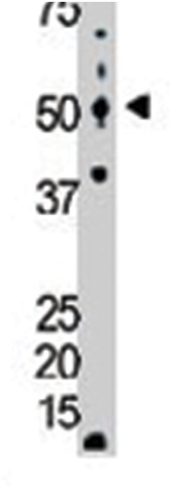 GCK Rabbit anti-Human, Polyclonal Antibody, Abnova 400&mu;L; Unlabeled:Antibodies,
