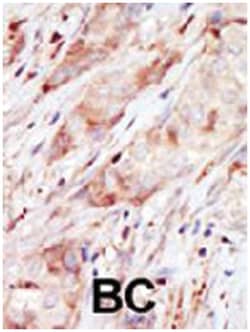 GCK Rabbit anti-Human, Polyclonal Antibody, Abnova 400&mu;L; Unlabeled:Antibodies,