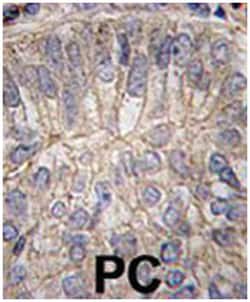 CDH3 Rabbit anti-Human, Polyclonal Antibody, Abnova 400 &mu;L | Buy Online | Abnova Corporation | Fisher Scientific