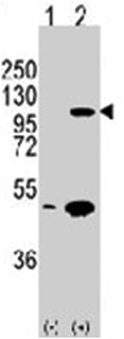 CDH3 Rabbit anti-Human, Polyclonal Antibody, Abnova 400 &mu;L | Buy Online | Abnova Corporation | Fisher Scientific