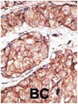 TLR5 Rabbit anti-Human, Mouse, Polyclonal Antibody, Abnova 400 &mu;L | Buy Online | Abnova Corporation | Fisher Scientific
