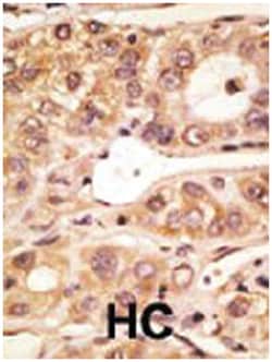 TLR5 Rabbit anti-Mouse, Polyclonal Antibody, Abnova 400&mu;L; Unlabeled:Antibodies,