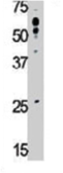 TLR6 Rabbit anti-Human, Polyclonal Antibody, Abnova 400 &mu;L | Buy Online | Abnova Corporation | Fisher Scientific