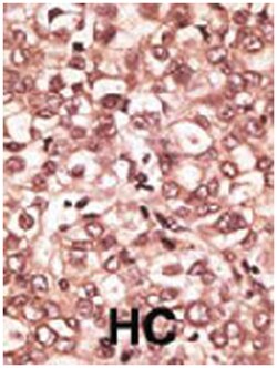 TLR6 Rabbit anti-Human, Polyclonal Antibody, Abnova 400 &mu;L | Buy Online | Abnova Corporation | Fisher Scientific