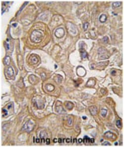 TLR6 Rabbit anti-Human, Polyclonal Antibody, Abnova 400 &mu;L | Buy Online | Abnova Corporation | Fisher Scientific