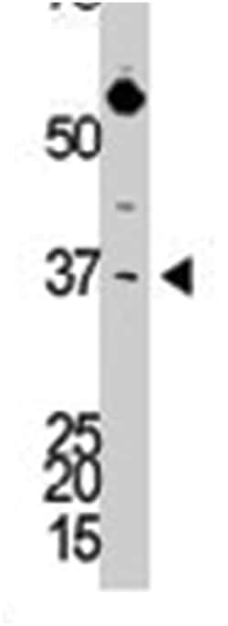 DKK3, Rabbit, Polyclonal Antibody, Abnova 400 &mu;L | Buy Online | Abnova Corporation | Fisher Scientific
