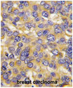 DKK3, Rabbit, Polyclonal Antibody, Abnova 400 &mu;L | Buy Online | Abnova Corporation | Fisher Scientific