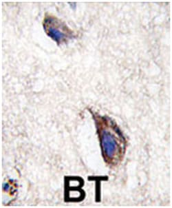 DKK3, Rabbit, Polyclonal Antibody, Abnova 400 &mu;L | Buy Online | Abnova Corporation | Fisher Scientific