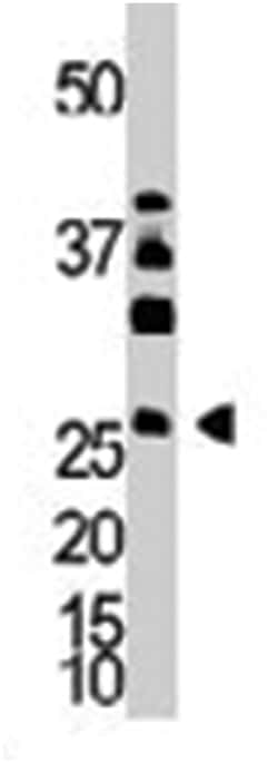 DKK4 Rabbit anti-Human, Polyclonal Antibody, Abnova 400&mu;L; Unlabeled:Anticuerpos