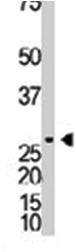 DKKL1, Rabbit, Polyclonal Antibody, Abnova 400&mu;L; Unlabeled:Antibodies,