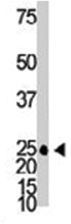 GJB2, Rabbit, Polyclonal Antibody, Abnova 400 &mu;L | Buy Online | Abnova Corporation | Fisher Scientific