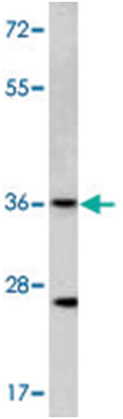 GJB3, Rabbit, Polyclonal Antibody, Abnova 400&mu;L; Unlabeled:Antibodies,