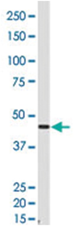 GJA5 Rabbit anti-Human, Polyclonal Antibody, Abnova 400 &mu;L | Buy Online | Abnova Corporation | Fisher Scientific