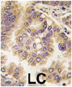 GJA5 Rabbit anti-Human, Polyclonal Antibody, Abnova 400 &mu;L | Buy Online | Abnova Corporation | Fisher Scientific