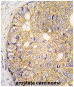 GJB6, Rabbit, Polyclonal Antibody, Abnova 400 &mu;L | Buy Online | Abnova | Fisher Scientific