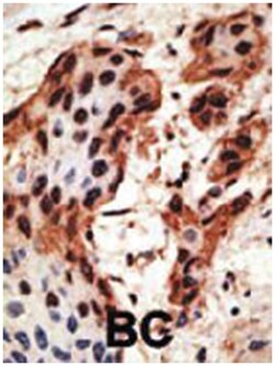 GJB6, Rabbit, Polyclonal Antibody, Abnova 400 &mu;L | Buy Online | Abnova | Fisher Scientific
