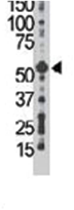 GJC1, Rabbit, Polyclonal Antibody, Abnova 400&mu;L; Unlabeled:Antibodies,